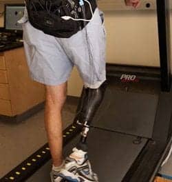 Technology Targets Prosthetic Discomfort in Amputees