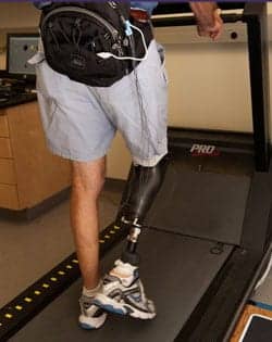 Technology Targets Prosthetic Discomfort in Amputees