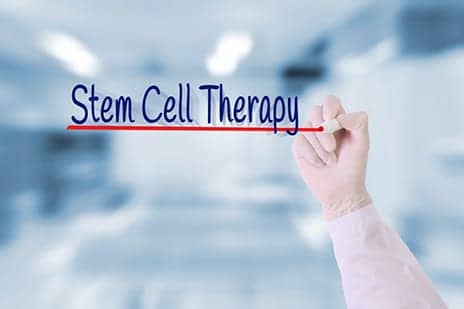 Stem Cell Therapy Aims to Help Improve Walking Ability in MS Patients