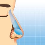 Screen for Smell Loss to Predict Frailty Risk and Unhealthy Aging