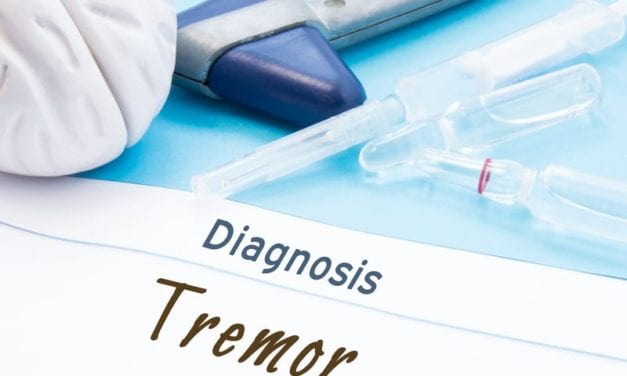 Cala Trio Essential Tremor Therapy Safe, Effective in Real-World Conditions, Per Data