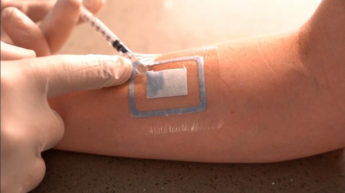 A Bandage that Says, "Change Me" Rehab Management