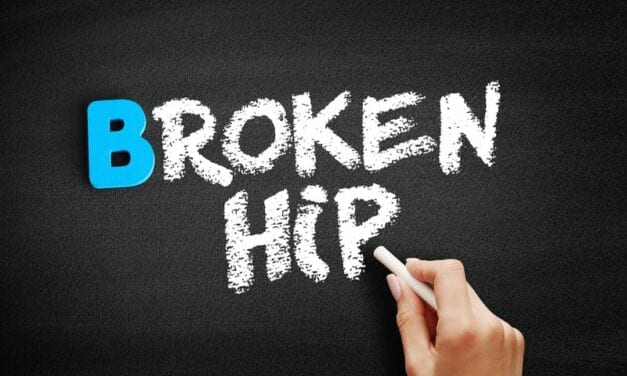 This May Increase the Mortality Risk After Hip Fracture