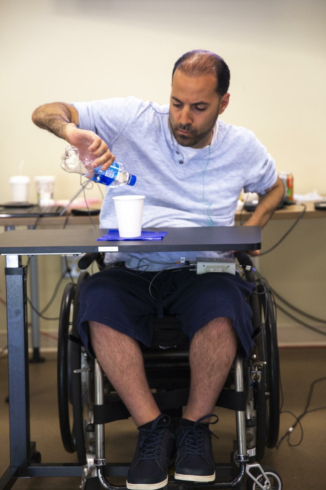 Complete Tetraplegia Hand Function Improves With Combo Treatment