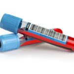 New Blood Test for ALS Promises Rapid Diagnosis