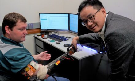 University of Minnesota Technology Allows Amputees to Control a Robotic Arm with Their Mind