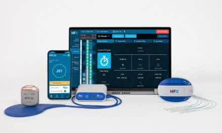 Transcutaneous Electrical Nerve Stimulation (TENS) & Interferential Current  Therapy (IFC) - Dubai Healthcare City