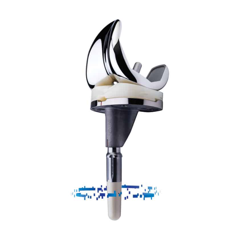 Atlantic Health System Offering Persona IQ Smart Knee Implant for TKA