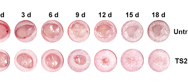 Nano Drug Shows Promise for Diabetic Wound Healing