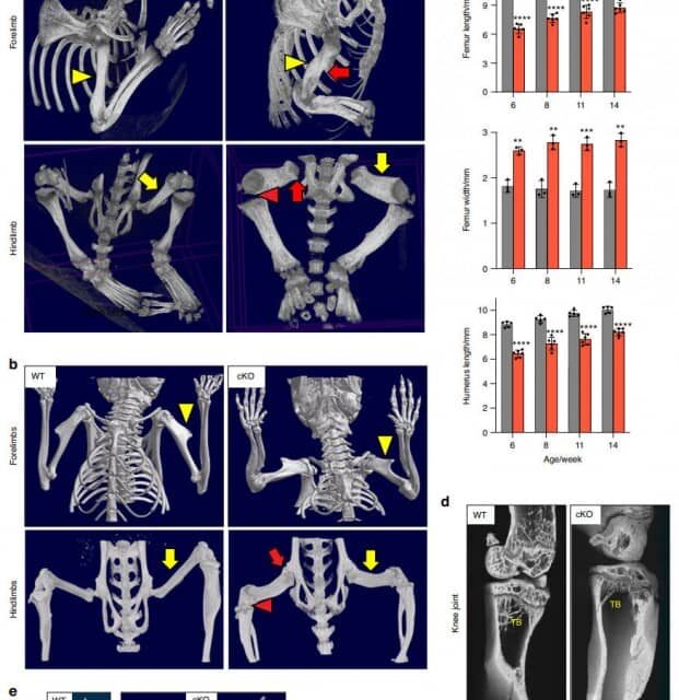 Study Reveals Critical Role of LRP1 in Skeletal Health, Disorders