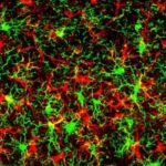 Scientists ID Protein That Heightens Neurodegenerative Disease