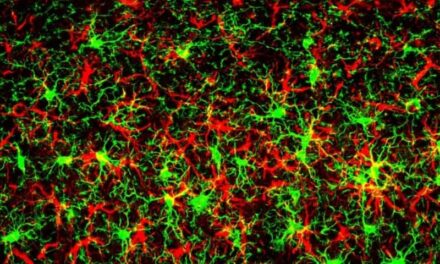 Scientists ID Protein That Heightens Neurodegenerative Disease