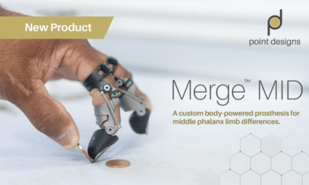 Merge MID Prosthesis Aims to Restore Function After Middle-Phalanx Amputations